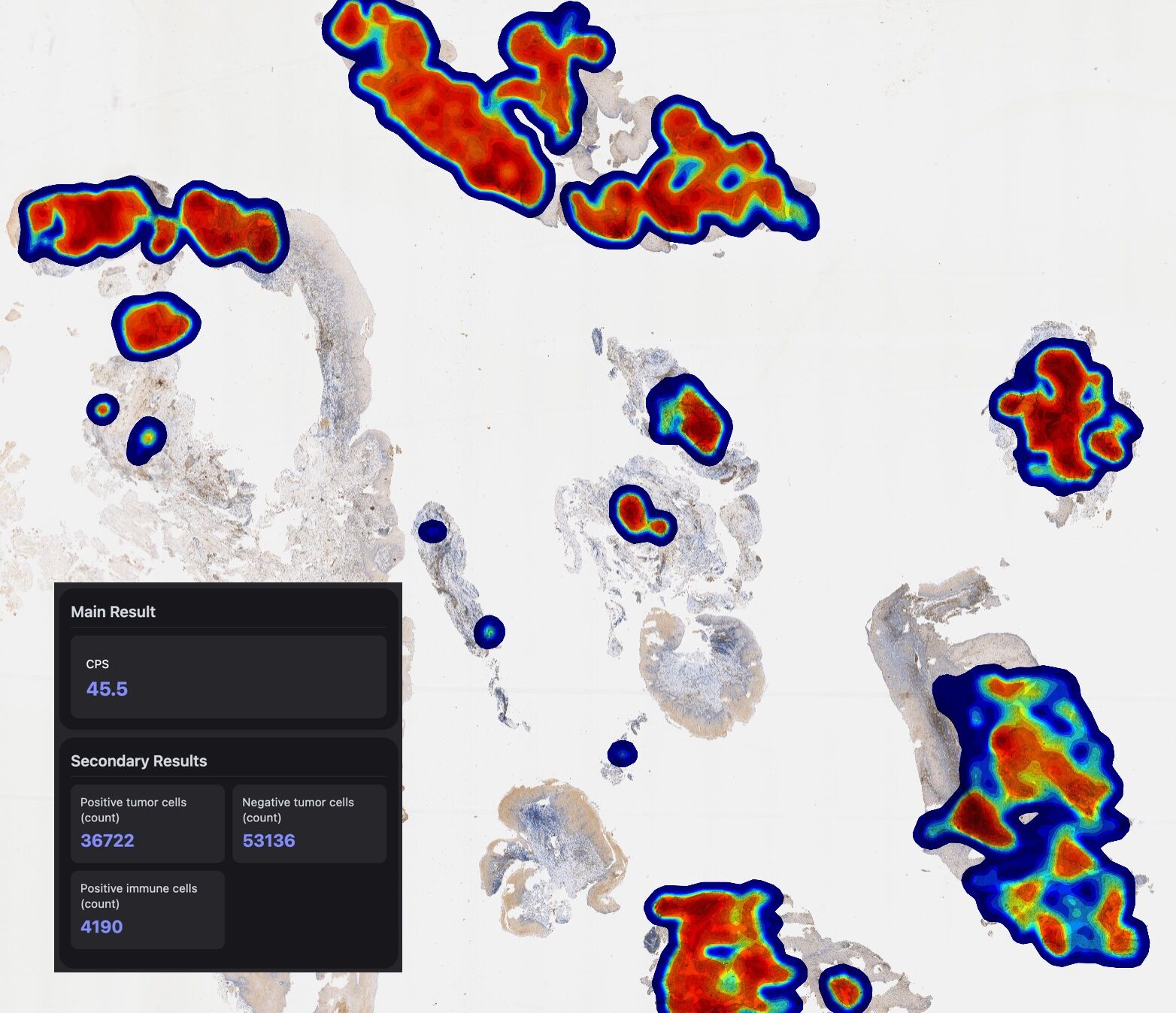 Quantification result reviewed alongside the heatmap