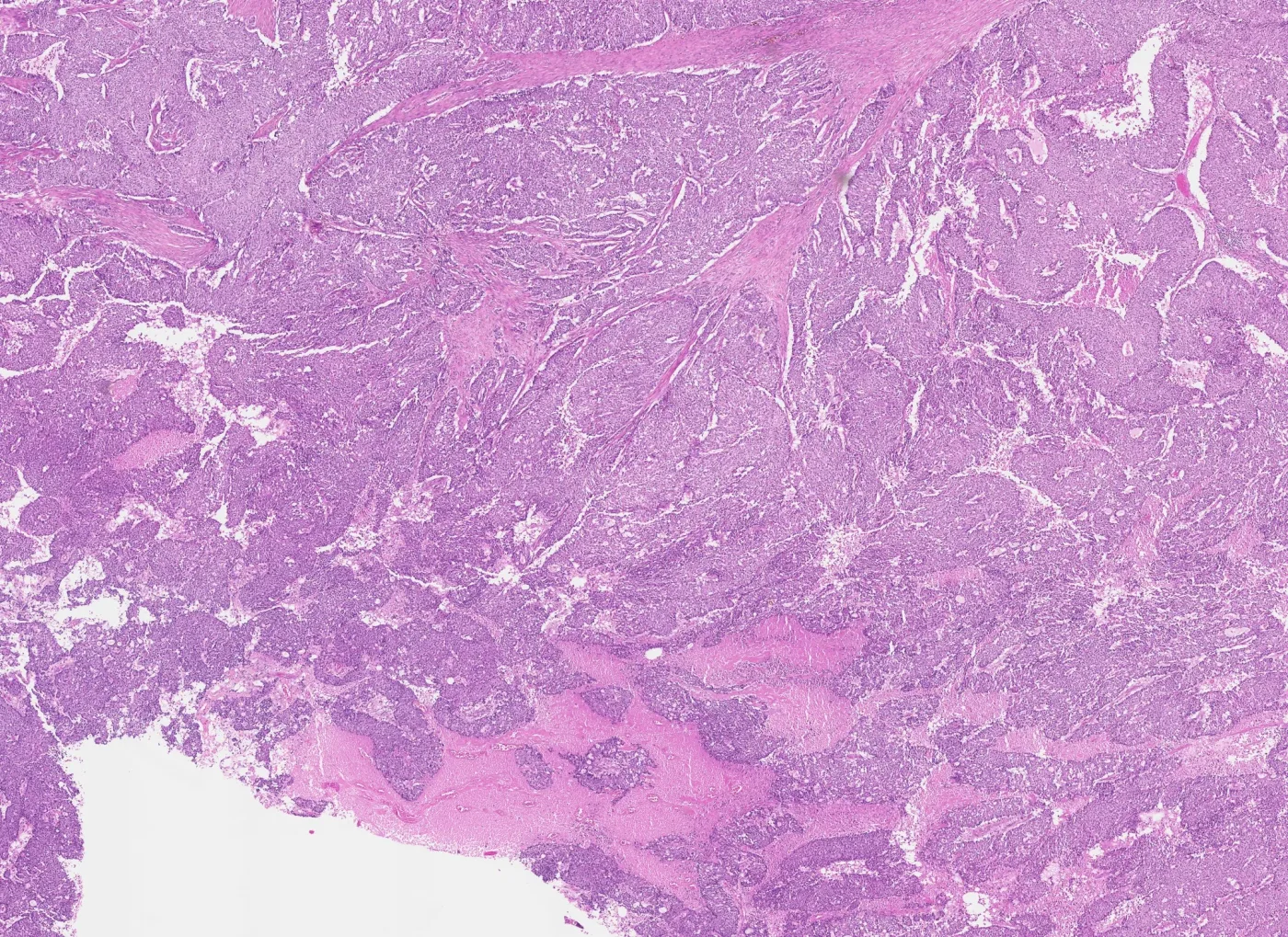 Histology tissue region